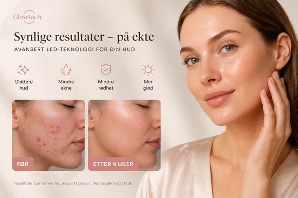 Glow Up Lumi™  Ultralett LED lys maske