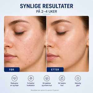 Dr Pen M9 Microneedling & Nanoneedling Pen